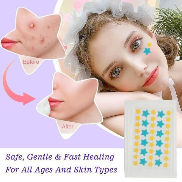 35pcs Pimples Anti Acné Patches 🏷1250 per pack