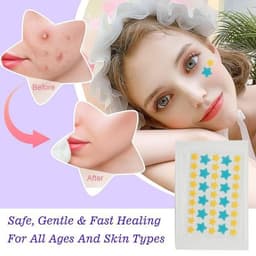 35pcs Pimples Anti Acné Patches 🏷1250 per pack