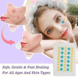 Acne patch
